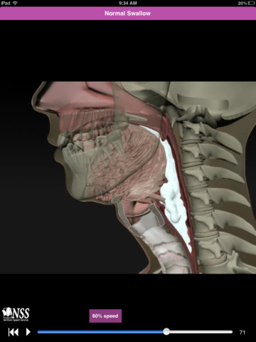 Dysphagia: animazioni 3-D riguardanti la deglutizione