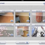 Micosi Cutanee: l’app per la diagnosi di patologia dermatologiche